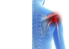 Baseball and Shoulder Injuries