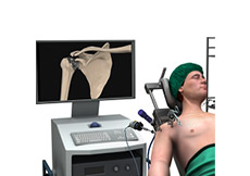 Minimally Invasive Shoulder Joint Replacement