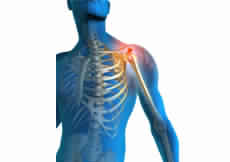 Shoulder Pain